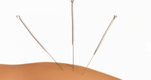 Acupuncture Needles