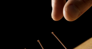 Inserting Acupuncture Needles
